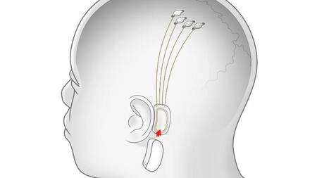 Propuesta de las primeras instalaciones de Neuralink. Foto: Neuralink
