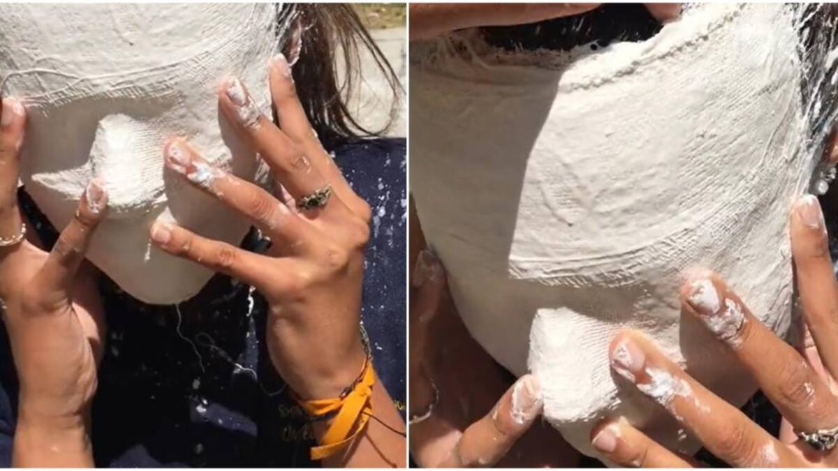 No se podía sacar el yeso de su cara. Foto: captura.