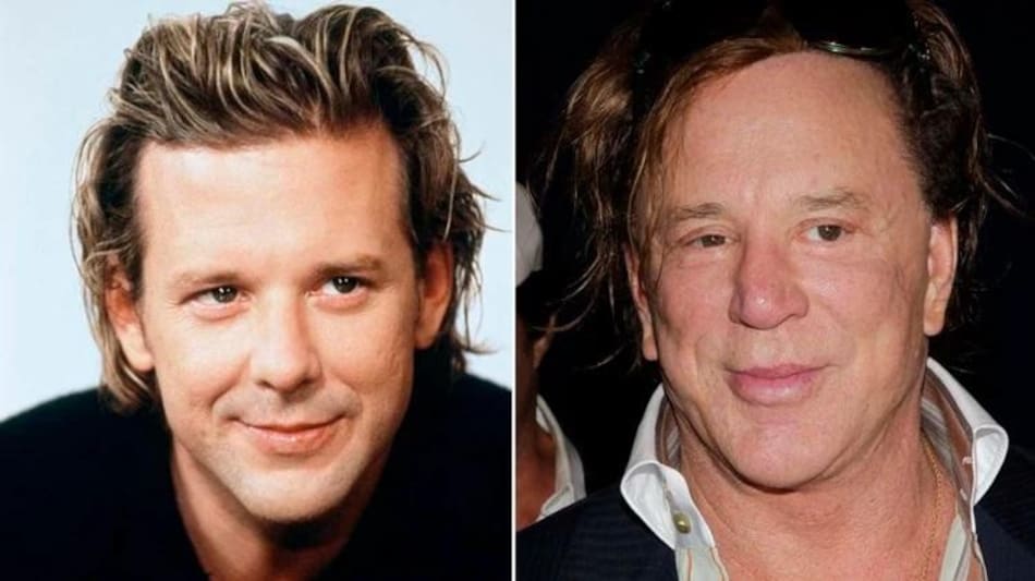 Mickey Rourke