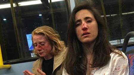 Azafata uruguay y novia agredidas en Londres