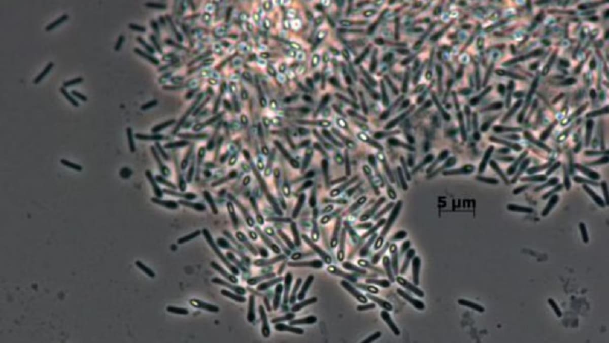 Bacteria Niallia circulans. Foto: Leibniz-Institut DSMZ