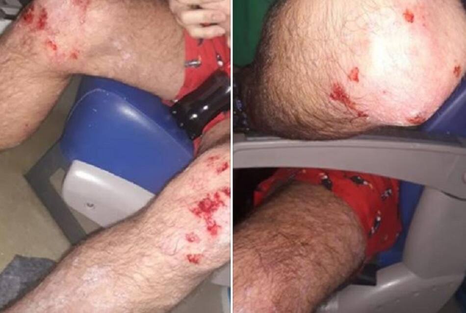 Ataque homofóbico en Villa Urquiza