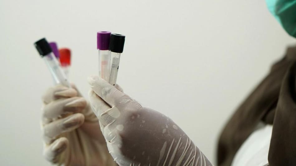 Laboratorio, médico, investigación, NA