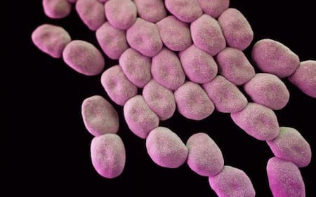 ¿Cuáles son las superbacterias más resistentes? Acinetobacter baumannii