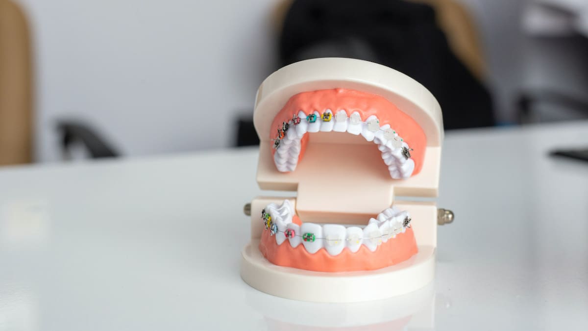 Brackets. Foto: Unsplash.