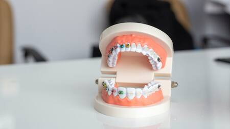 Brackets. Foto: Unsplash.