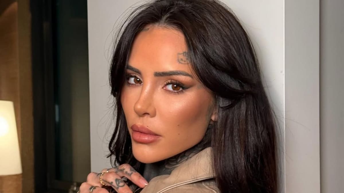 Cande Tinelli comenzó a borrar uno de los tatuajes más visibles de su rostro.