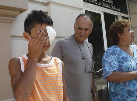 Quemadura en niños. Foto: NA