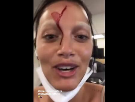 El accidente que sufrió Oriana Sabatini en Miami y que preocupó a sus fanáticos