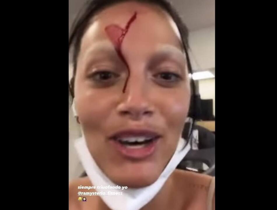 El accidente que sufrió Oriana Sabatini en Miami y que preocupó a sus fanáticos