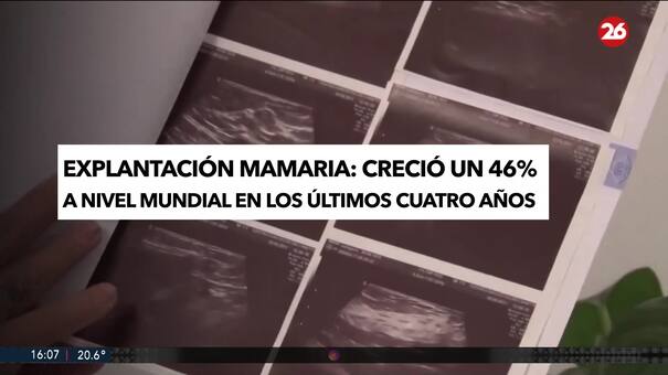 La explantación mamaria creció un 46% a nivel mundial en los últimos cuatro años