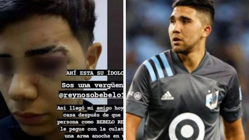 Joven agredido por el jugador "Bebelo" Reynoso