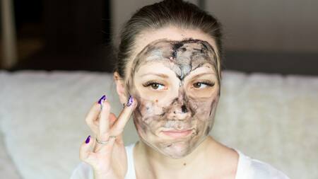 Acné, granos, piel. Foto: Unsplash