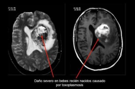 Parásito que ingresa al ser humano a través de gatos