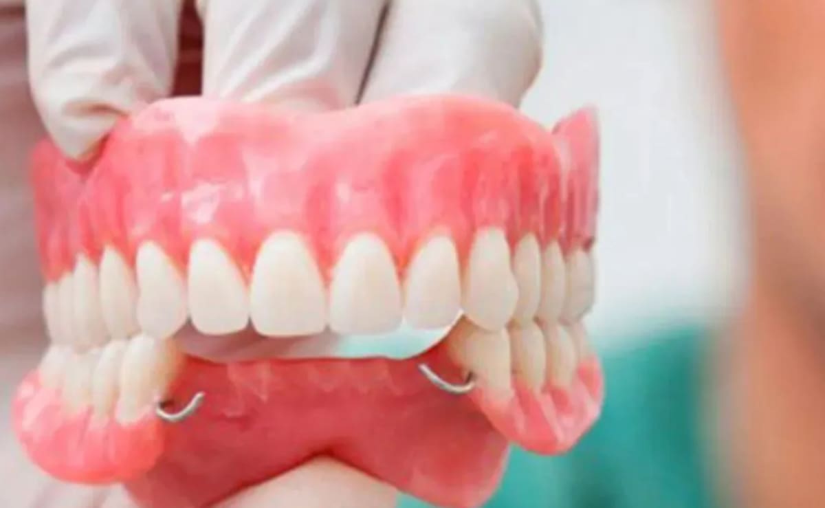 Todo lo que hay que saber sobre las prótesis dentales de PAMI