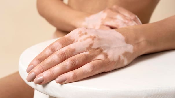 La importancia de exfoliar tus manos: las 5 razones fundamentales cuidar tu piel con este método