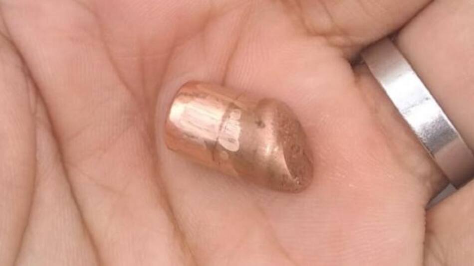La bala perdida que casi mata a la mujer en La Plata. Foto: NA.