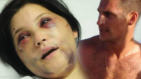 Joven agredida por anestesista - Anestesista