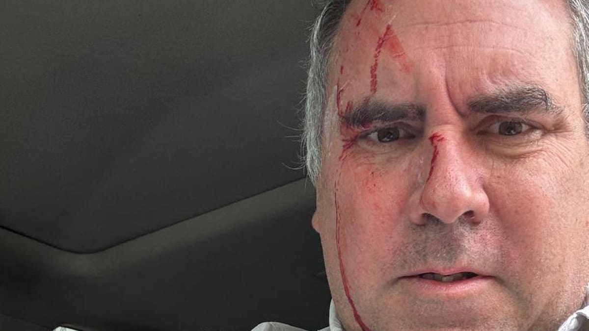 Atentado contra Rafael Belaúnde Llosa, candidato a presidente de Perú.
