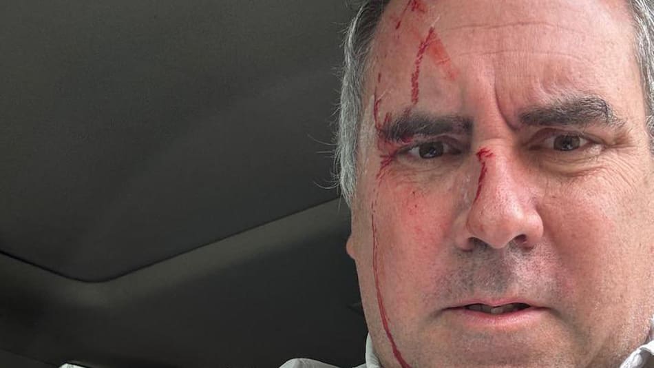 Atentado contra Rafael Belaúnde Llosa, candidato a presidente de Perú.