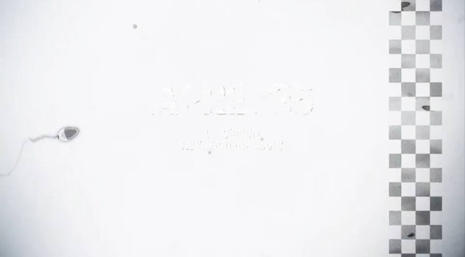 Carrera de espermatozoides. Foto: captura.