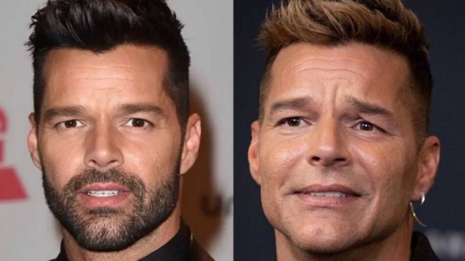 Ricky Martin, antes y después