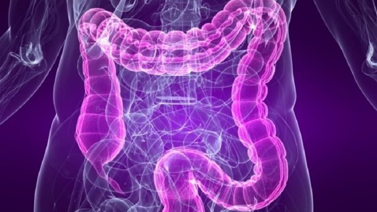Colón, Cáncer de colon, intestino, salud