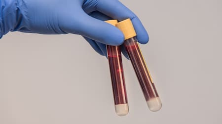 Investigadores trabajaron en la posibilidad de cambiar de grupo sanguíneo. Foto: Pixabay.