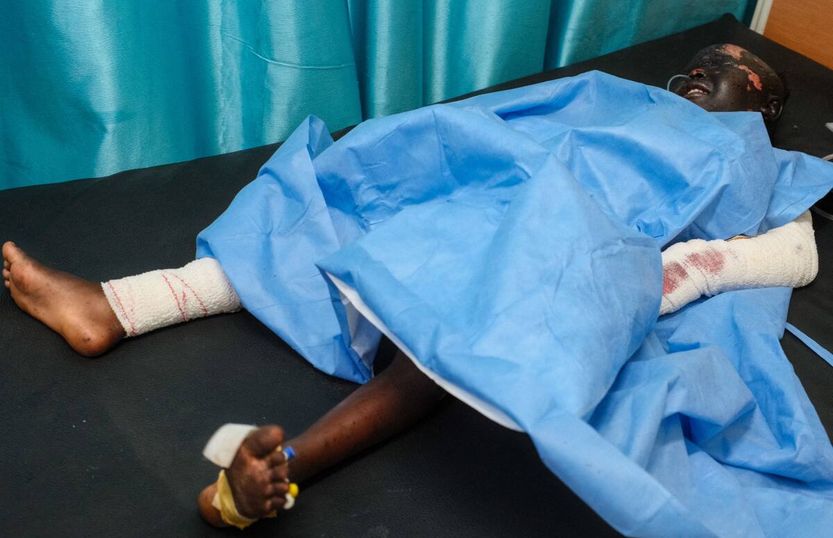 Las consecuencias de la guerra en Sudán que padecen los niños. Foto: Reuters/El Tayeb Siddig.
