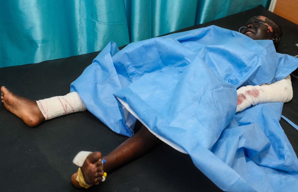 Las consecuencias de la guerra en Sudán que padecen los niños. Foto: Reuters/El Tayeb Siddig.