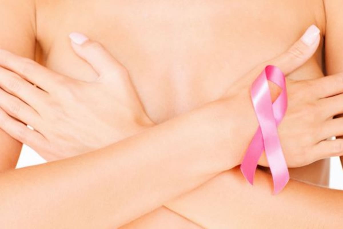 Cáncer de mama