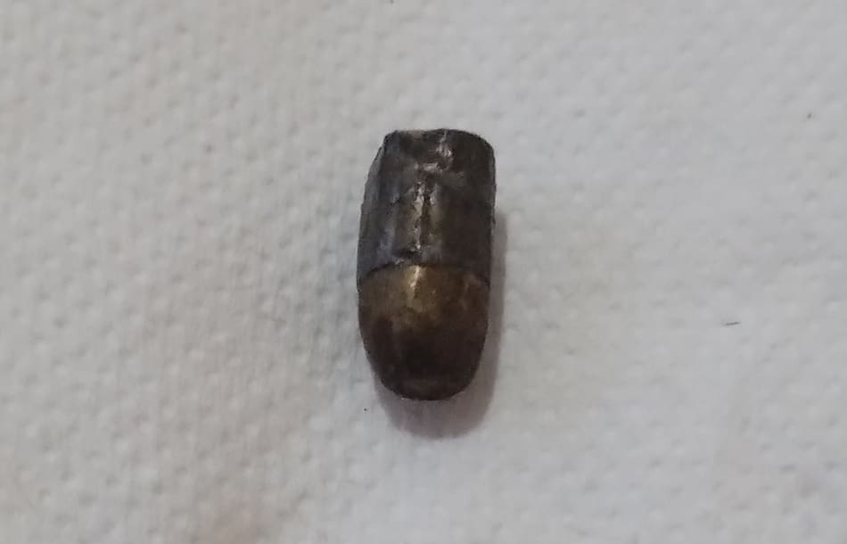 El perdigón hallado dentro de la empanada. Foto: Facebook.