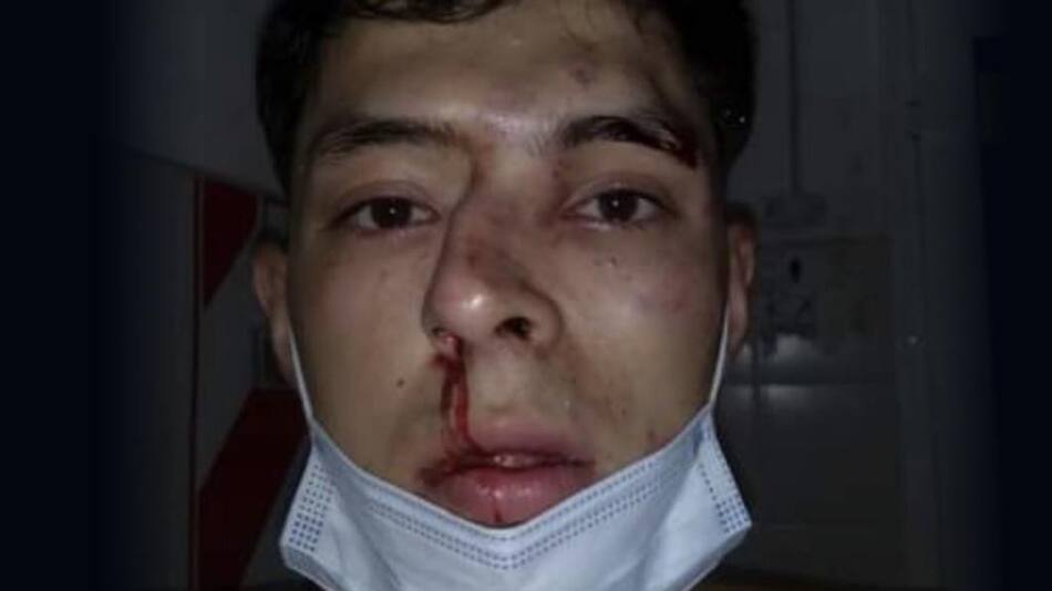 Estudiante de periodismo atacado en Chaco, NA, Twitter