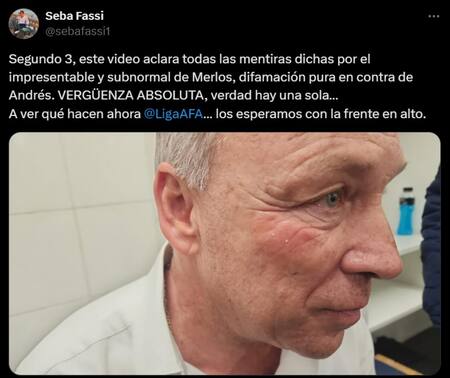 La fotografía que compartió el hijo de Andrés Fassi. Foto: X @sebafassi1.