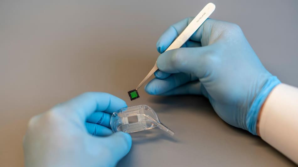 Prueban con éxito el primer riñón bioartificial que evitará futuras diálisis