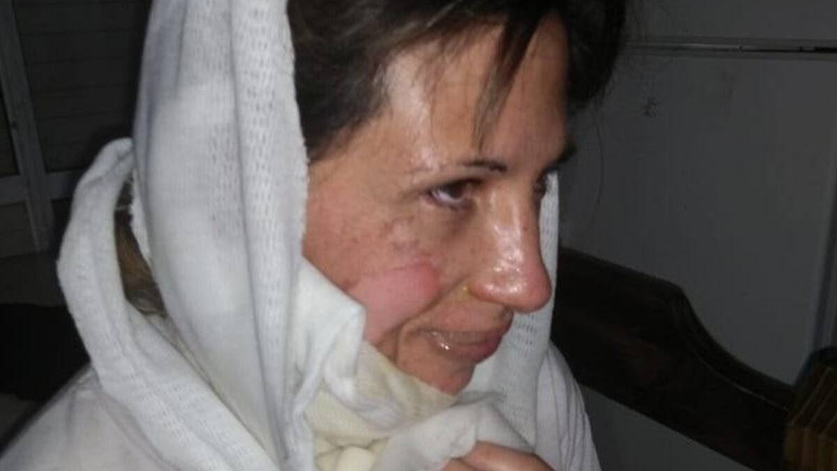 Mujer quemada en Bahía Blanca