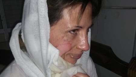 Mujer quemada en Bahía Blanca