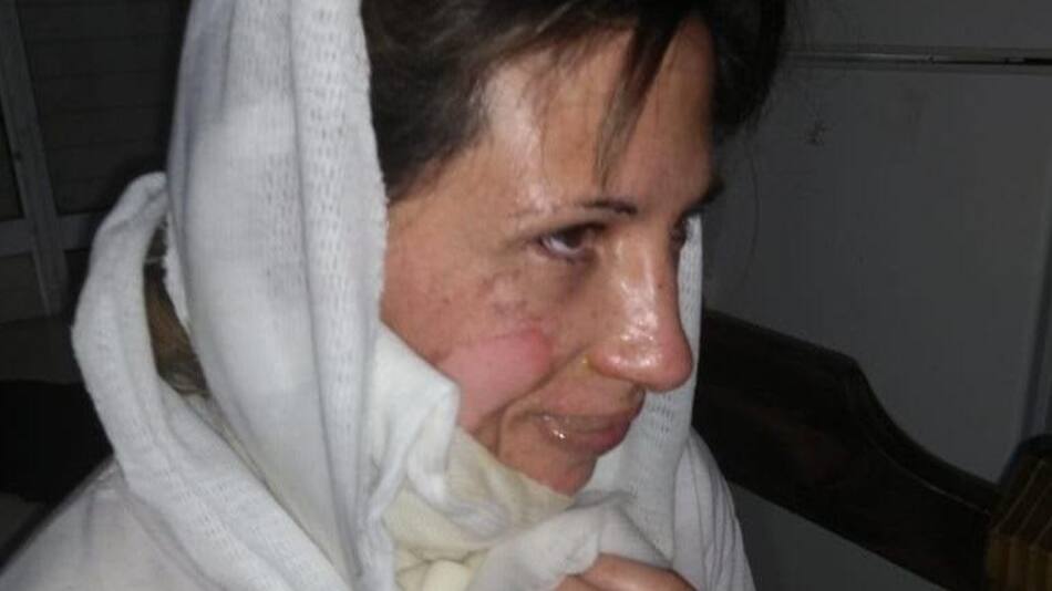 Mujer quemada en Bahía Blanca