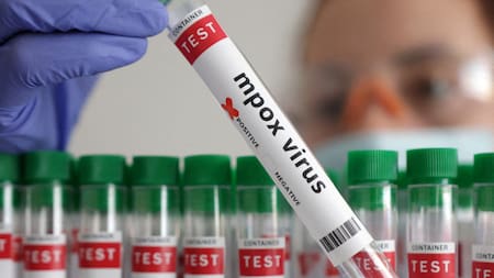 Mpox virus; viruela del mono. Foto: Reuters.