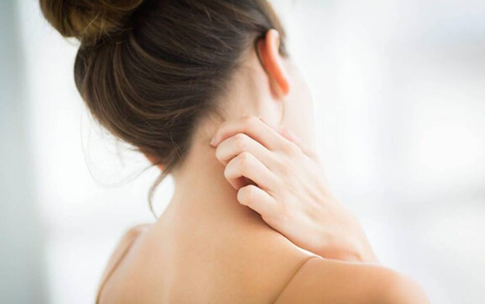 Dermatitis atópica, enfermedad de la piel, salud