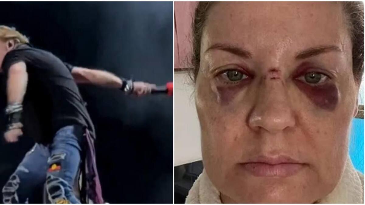 Accidente con el micrófono de Axl Rose. Fotos: captura-Twitter/LeoVilhena51