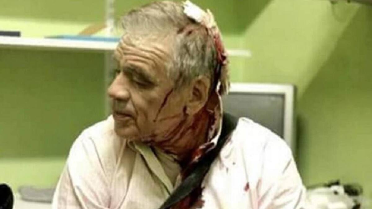 Agresión a Julio Bazán