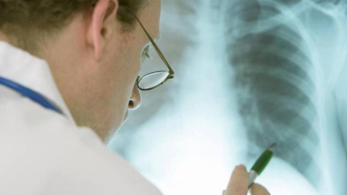 Alerta EPOC: cómo prevenir la enfermedad que afecta a más de dos millones de argentinos