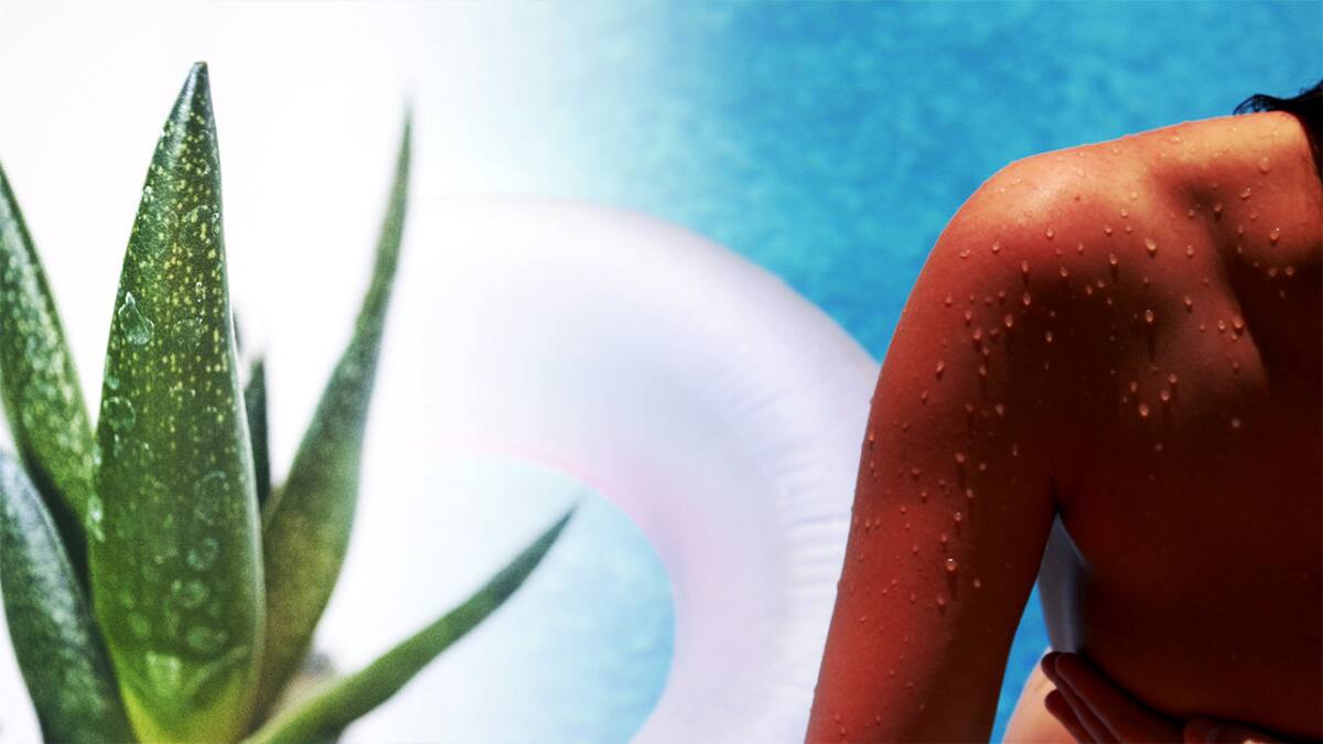 Aloe vera. Foto: Pexel