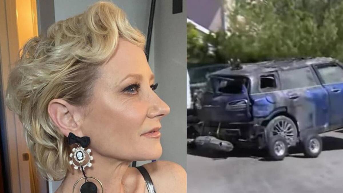 Anne Heche en coma. Foto: Instagram/anneheche - fox