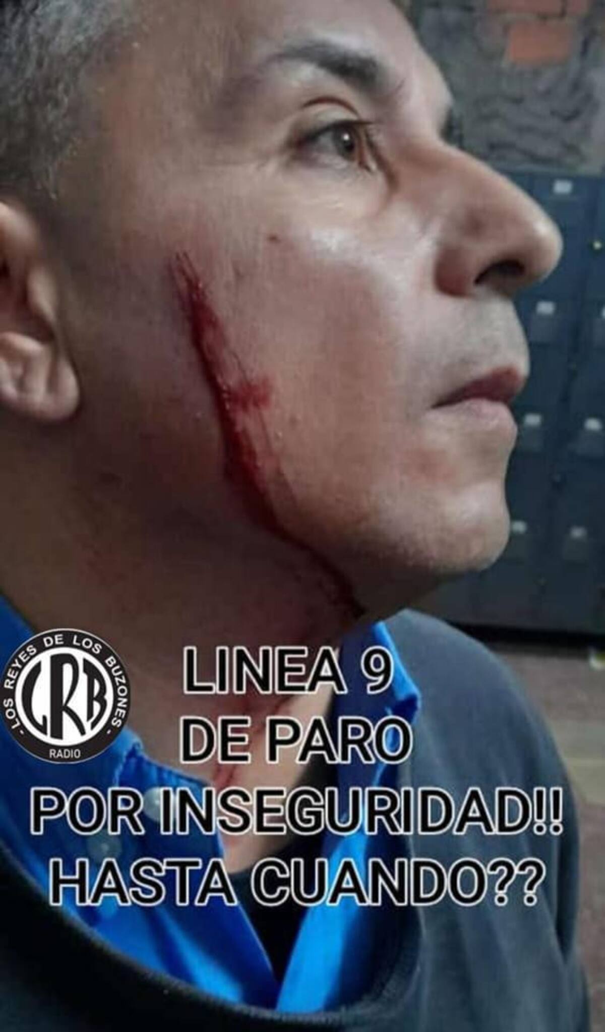 Así quedó el chofer de la línea 9. Foto: Facebook: Choferes Línea 9.