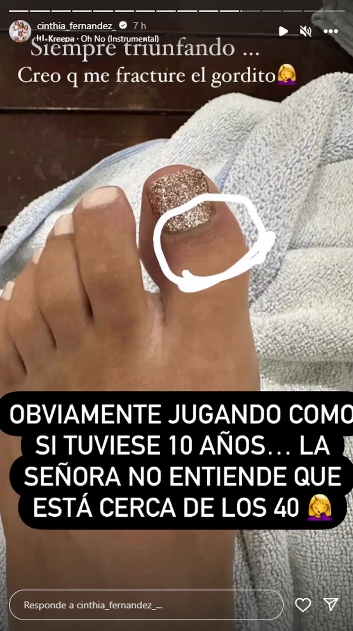 Así quedó el dedo de Cinthia Fernández. Foto: Instagram