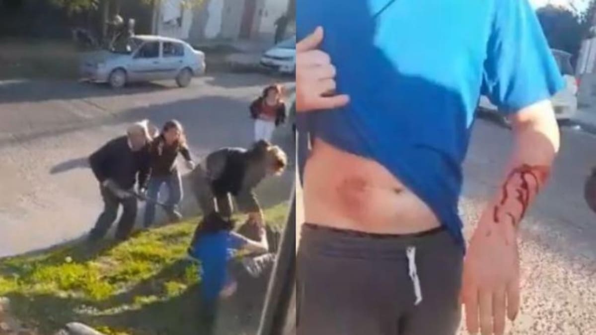 Ataque de un pitbull a un hombre en Bahía Blanca. Foto: NA