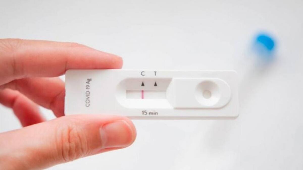 Autotest contra el coronavirus