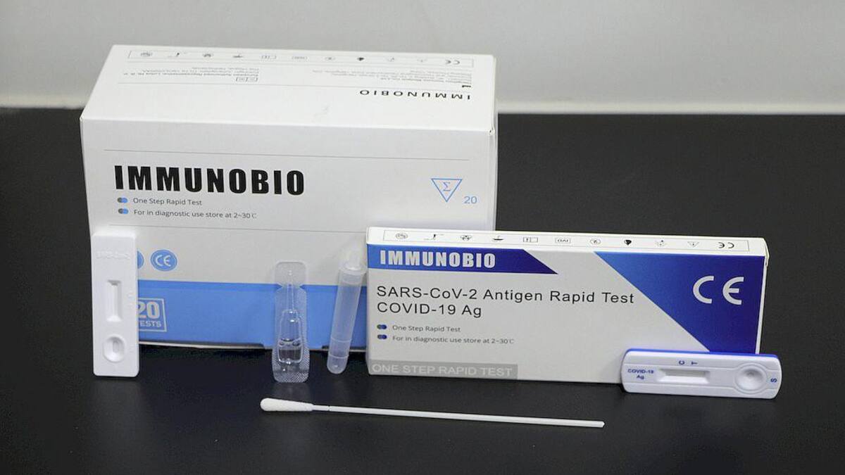 Autotest de coronavirus, foto NA